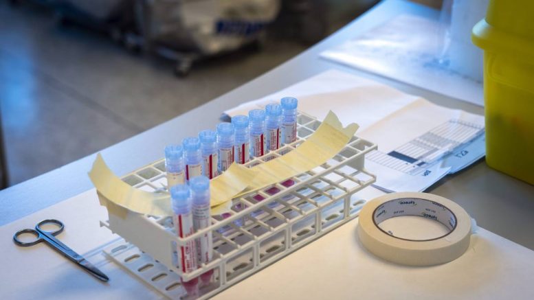 Séquençage Corona - test