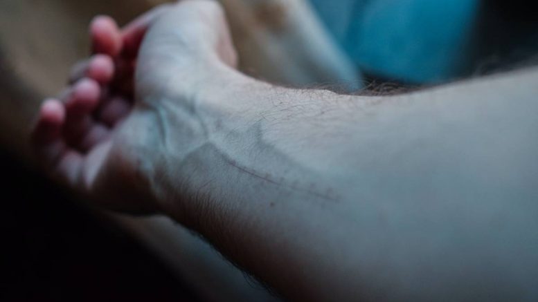 Mort - mort - suicide